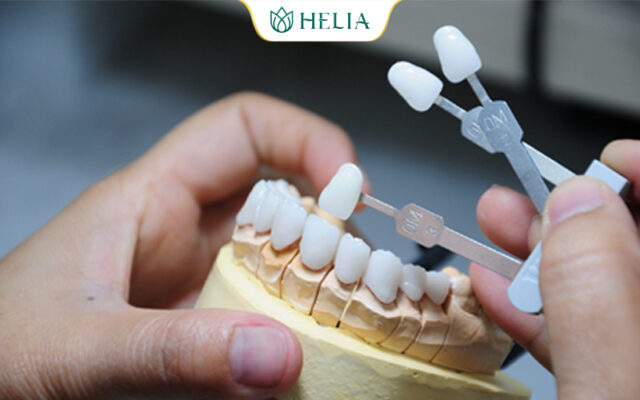 Bọc răng sứ khắc phục tình trạng răng ố vàng/xỉn màu/nhiễm Tetracyline chỉ sau 48h