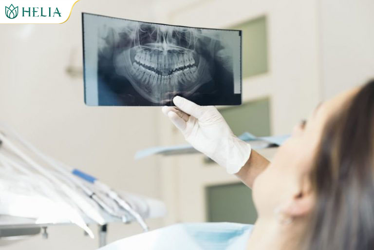 Đội ngũ bác sĩ uy tín gần 20 năm kinh nghiệm trực tiếp lên phác đồ điều trị