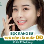 Bọc răng sứ trả góp tại HELIA Bọc sứ trả góp tại HELIA chỉ từ 299k