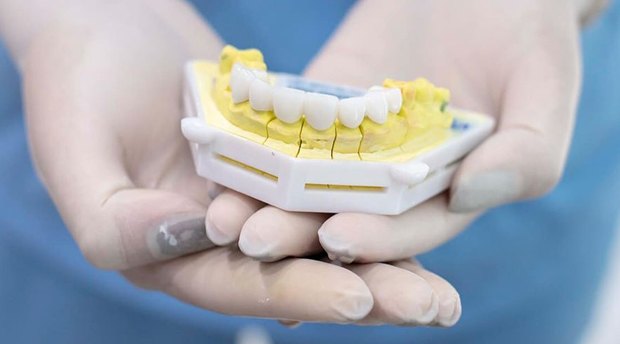 Phòng điều trị trồng răng Implant