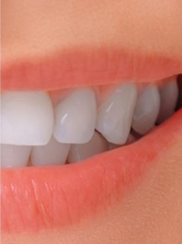Nụ cười sau điều trị